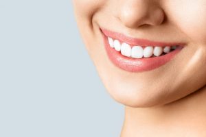 Porcelain dental crowns - dentist in Swansea, IL